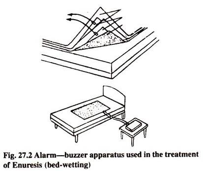 Alaram-Buzzer Apparatus Used in the Treatment of Enuresis